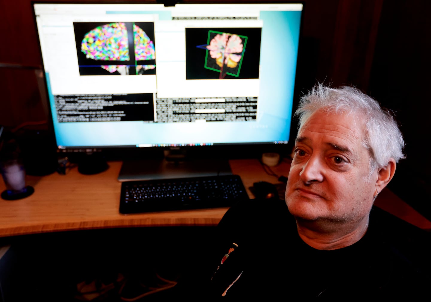 El Dr. Bruce Fischl, profesor de radiología en la Facultad de Medicina de Harvard, investiga sobre la intersección entre informática y neurorradiología en el Hospital General de Massachusetts.