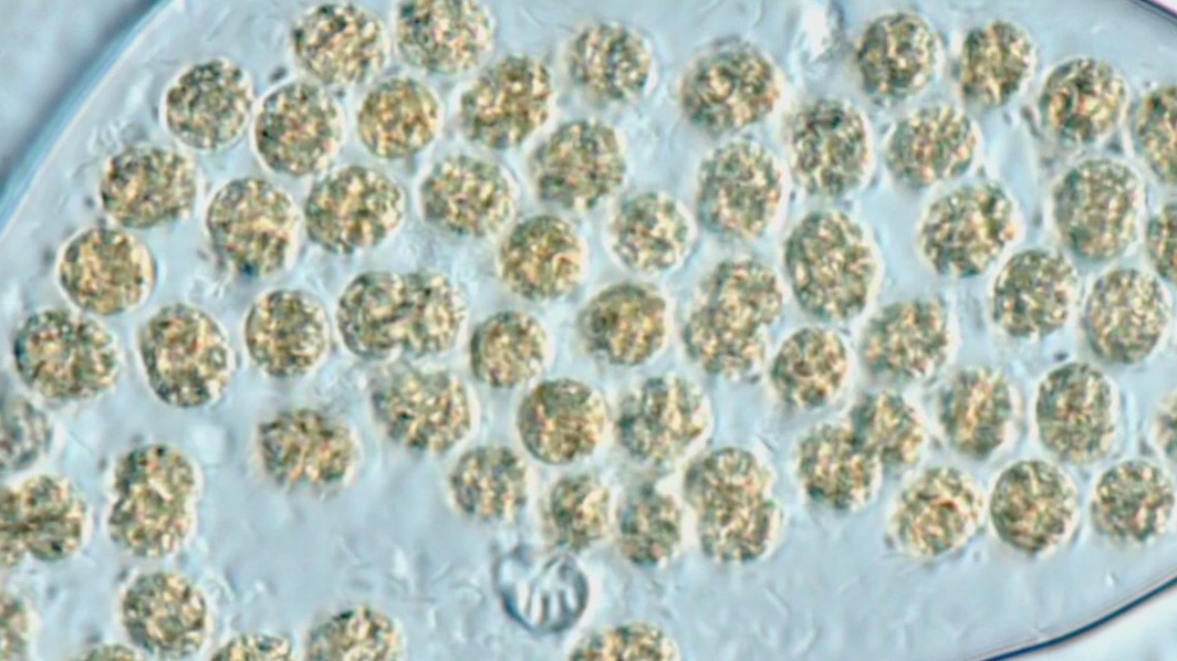 Breakthroughs in Science: la lucha de los científicos contra las algas tóxicas