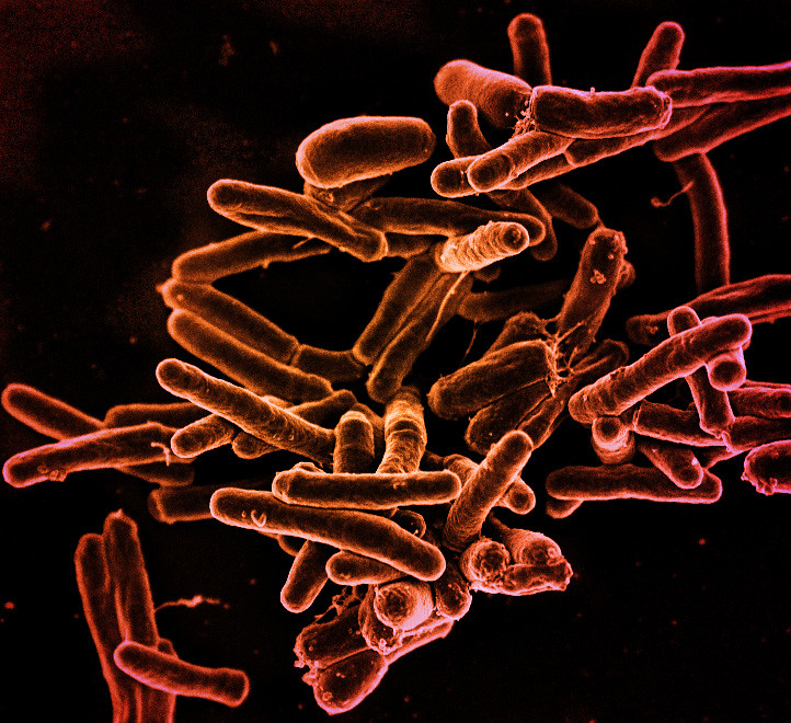 Partículas de tuberculosis bajo un microscopio
